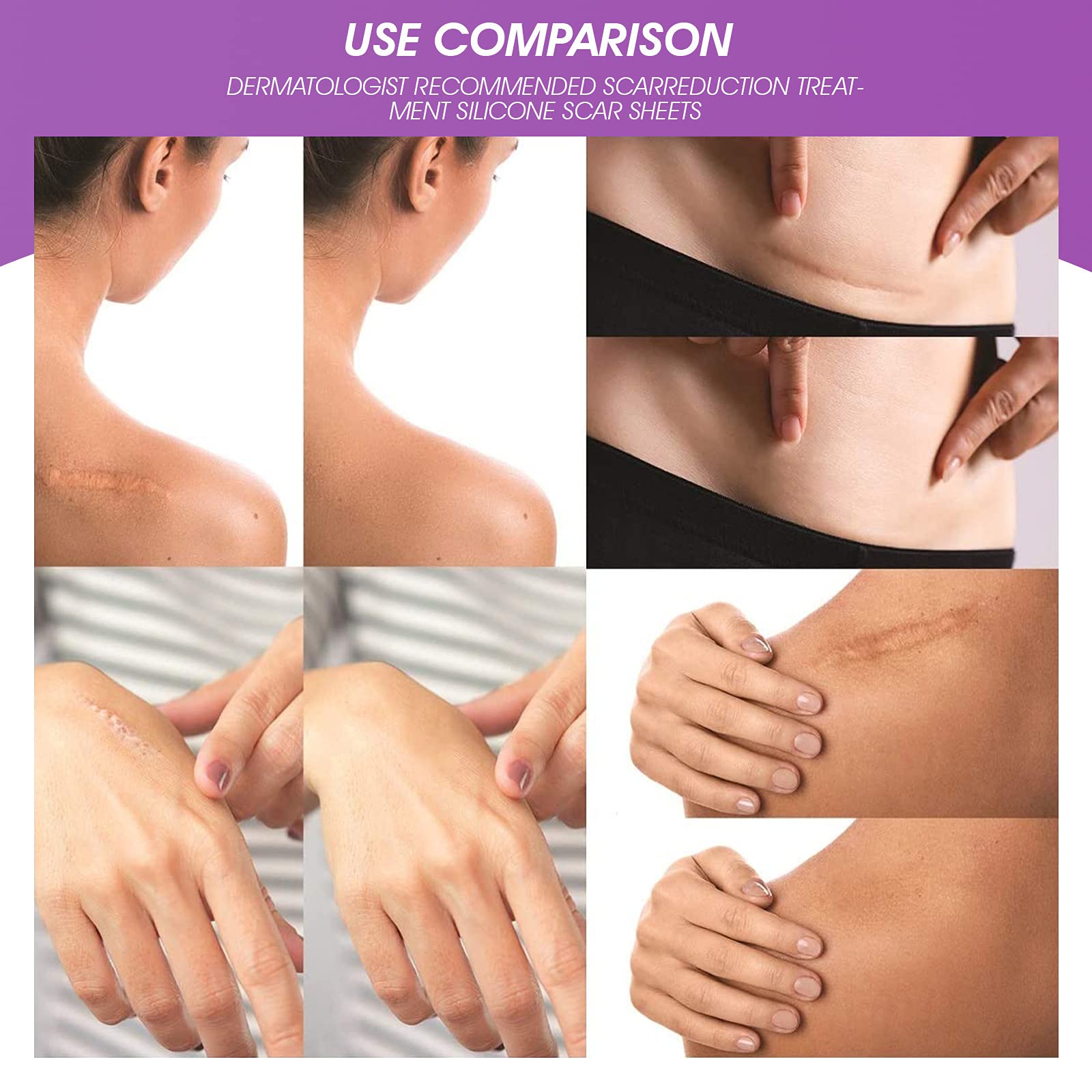 MAYCREATE Scars Removal Sheets Silicone Gel Scars Recovery Sticker Strip Waterproof Improve Scar Constitution Tissue Restore Regeneration 15 * 4cm 4 Sheets MAYCREATE Scars Removal Sheets Silicone Gel Scars Recovery Sticker Strip Waterproof Improve Scar Constitution Tissue Restore Regeneration 15 * 4cm 4 Sheets